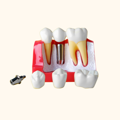 Artificial Teeth