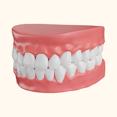 Flexible Denture